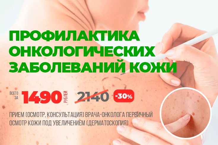 Акция: «Профилактика онкологических заболеваний кожи»