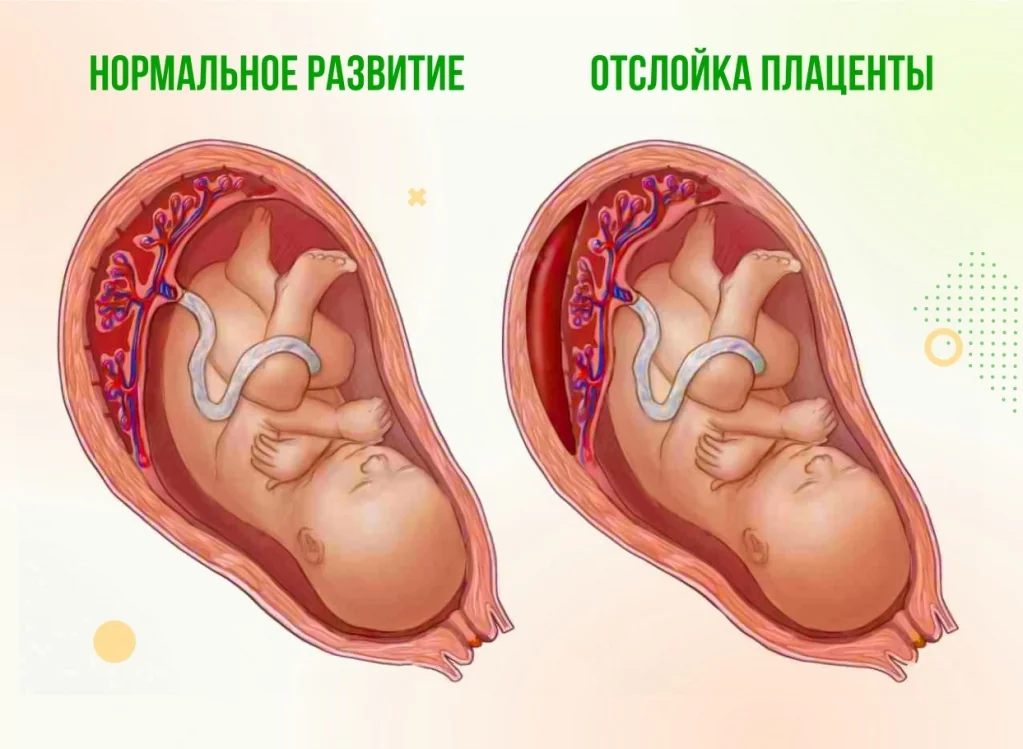 Когда происходит имплантация после переноса эмбрионов?