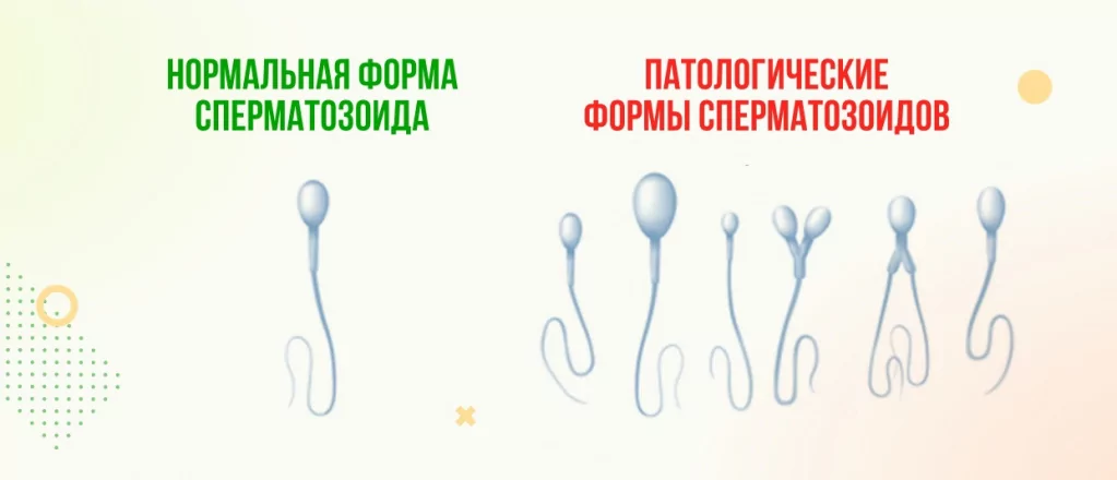 Морфология по Крюгеру (оценка внешнего строения сперматозоидов) в Ростове-на-Дону