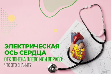 Электрическая ось сердца отклонена влево или вправо: что это значит?