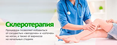Склеротерапия