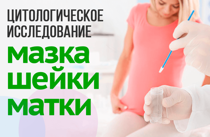 Мазок на флору у женщин (соскоб) - сдать мазок в Москве | Медицинский центр «Президент-Мед»