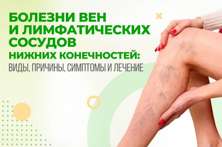 Болезни вен и лимфатических сосудов нижних конечностей: виды, причины, симптомы и лечение