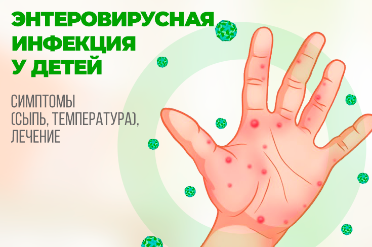 Насколько опасны энтеровирусные инфекции у детей: по каким симптомам распознать и чем лечить.