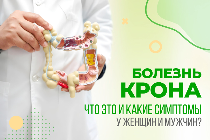 Болезнь Крона — что это и какие симптомы у женщин и мужчин?